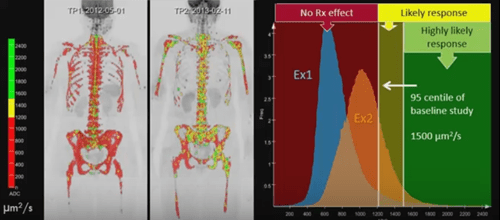 Whole body MRI scan example
